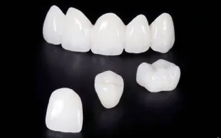 セラミック矯正