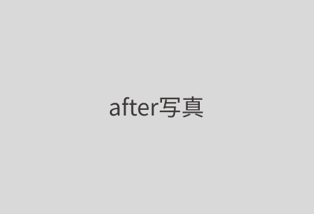 症例1 After