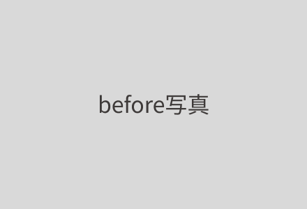 症例1 Before