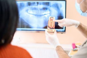 インプラント・差し歯の治療ができる人の特徴
